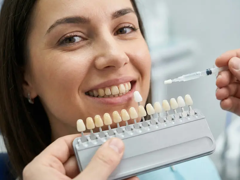 Ergebnis der Zahnaufhellung