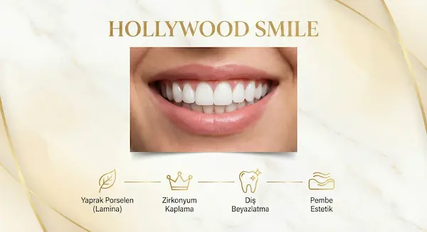 Hollywood Smile Lächeln-Design